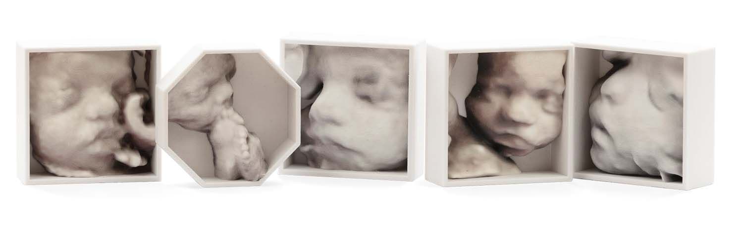 Pavels Innovation og deres 3D-printere gjør det mulig å få et bilde av babyen fra 2. trimester